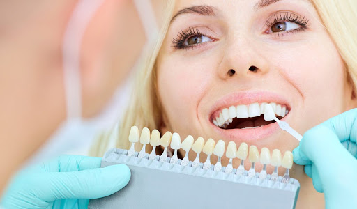 Lente de contato dental